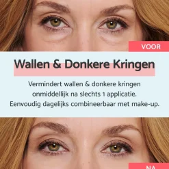 Remescar Wallen & Donkere Kringen Crème